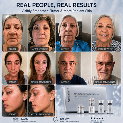 𝐏𝐡𝐲𝐬𝐢𝐜𝐢𝐚𝐧-𝐅𝐨𝐫𝐦𝐮𝐥𝐚𝐭𝐞𝐝 🎯 | 𝐌𝐑𝐄𝐕𝐁𝐒𝐈𝐍® 𝐀𝐝𝐯𝐚𝐧𝐜𝐞𝐝 𝐀𝐧𝐭𝐢-𝐀𝐠𝐢𝐧𝐠 𝐌𝐢𝐜𝐫𝐨-𝐈𝐧𝐟𝐮𝐬𝐢𝐨𝐧 𝐊𝐢𝐭 · 𝐌𝐮𝐥𝐭𝐢-𝐏𝐞𝐩𝐭𝐢𝐝𝐞 𝐒𝐞𝐫𝐮𝐦 × 𝐏𝐫𝐞𝐜𝐢𝐬𝐢𝐨𝐧 𝐌𝐢𝐜𝐫𝐨𝐧𝐞𝐞𝐝𝐥𝐞 𝐈𝐧𝐟𝐮𝐬𝐢𝐨𝐧